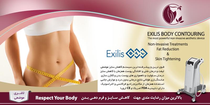 unnamed1 exilis