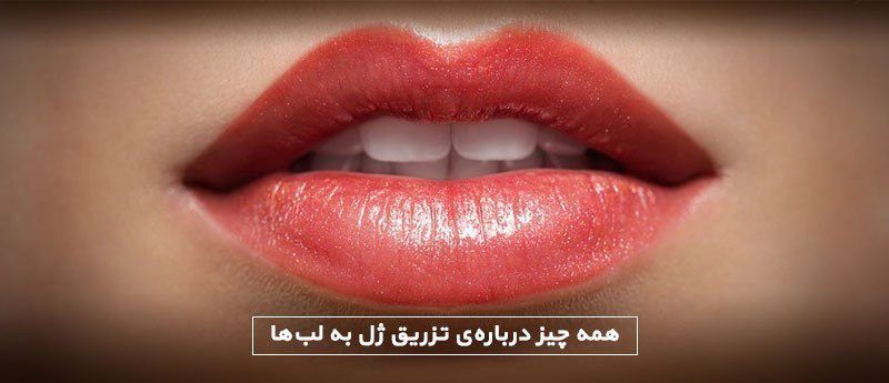 IMG_20180825_165811 تزریق ژل