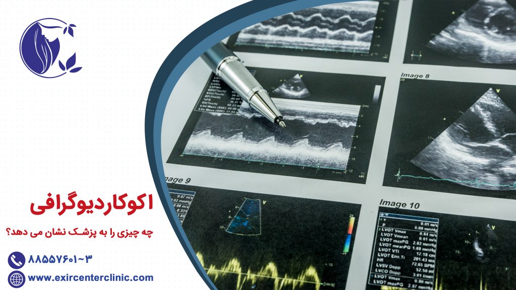 اکوقلب