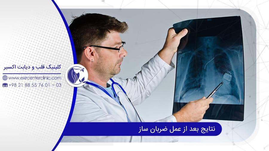 نتایج عمل باطری قلب